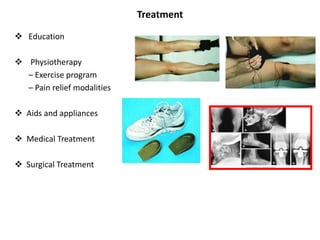 Treatment
 Education
 Physiotherapy
– Exercise program
– Pain relief modalities
 Aids and appliances
 Medical Treatment
 Surgical Treatment
 