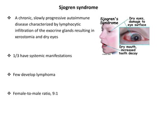 Sjogren syndrome
 A chronic, slowly progressive autoimmune
disease characterized by lymphocytic
infiltration of the exocrine glands resulting in
xerostomia and dry eyes
 1/3 have systemic manifestations
 Few develop lymphoma
 Female-to-male ratio, 9:1
 