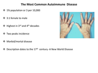 The Most Common Autoimmune Disease
 1% population or 3 per 10,000
 3:1 female to male
 Highest in 3rd and 4th decades
 Two peaks incidence
 Morbid/mortal disease
 Description dates to the 17th century -A New World Disease
 