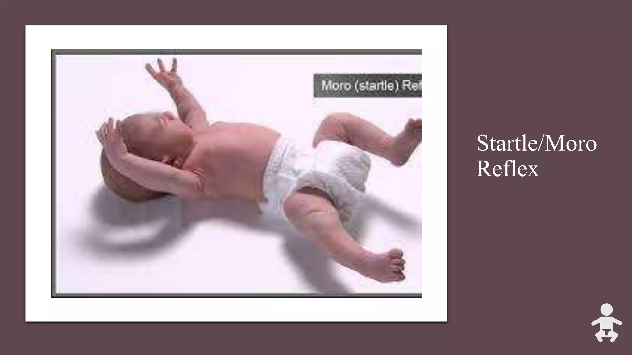 Startle/Moro
Reflex
 