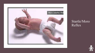 Startle/Moro
Reflex
 