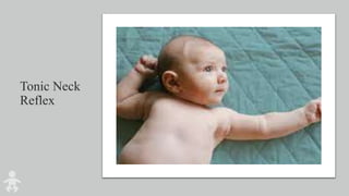 Tonic Neck
Reflex
 