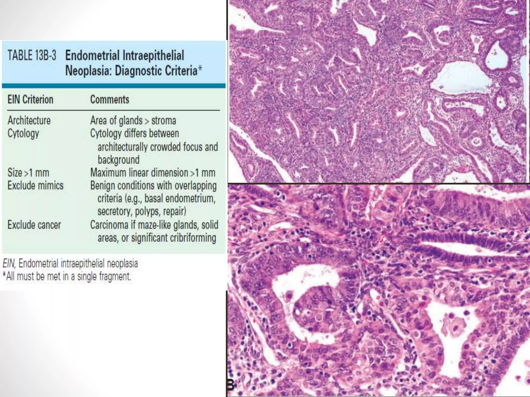Various types of endometrial carcinoma | PPTX