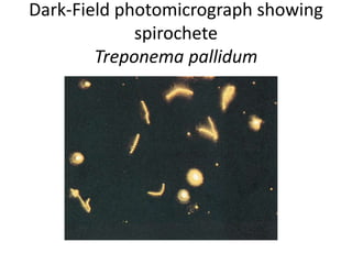 Dark-Field photomicrograph showing
spirochete
Treponema pallidum
 