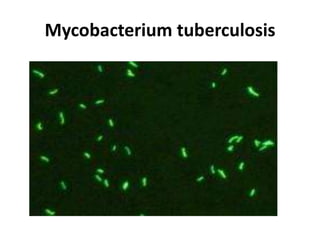 Mycobacterium tuberculosis
 