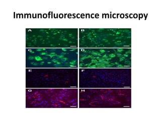 Immunofluorescence microscopy
 