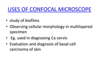 USES OF CONFOCAL MICROSCOPE
• study of biofilms
• Observing cellular morphology in multilayered
specimen
• Eg. used in diagnosing Ca cervix
• Evaluation and diagnosis of basal cell
carcinoma of skin
 