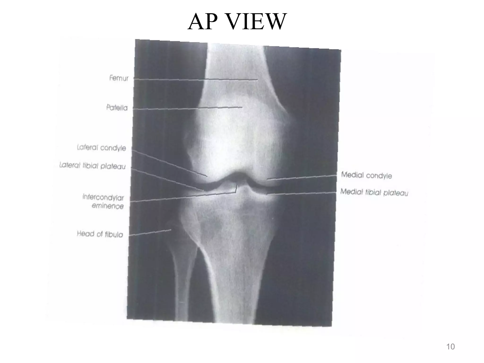 AP VIEW
10
 