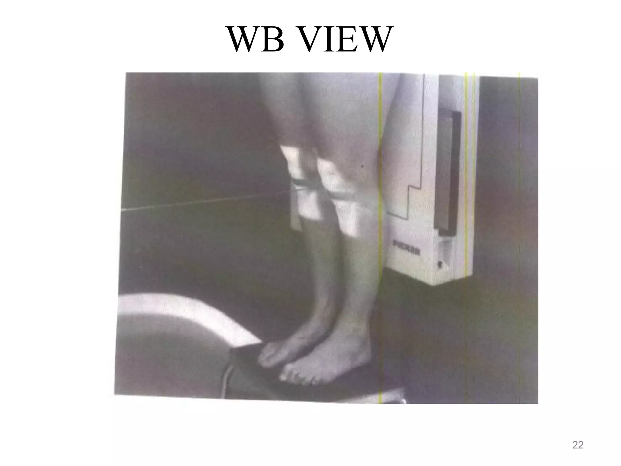 WB VIEW
22
 