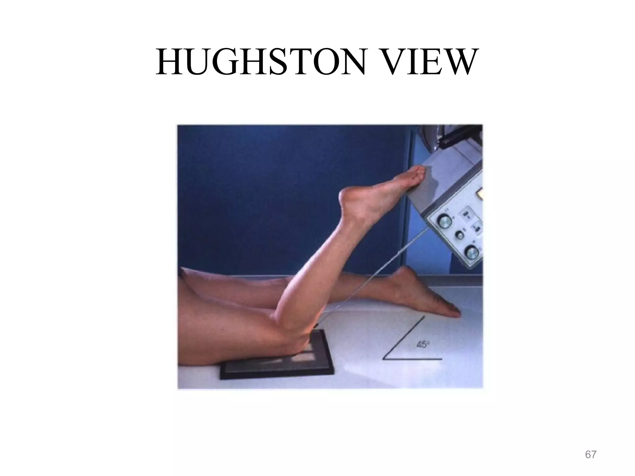 HUGHSTON VIEW
67
 