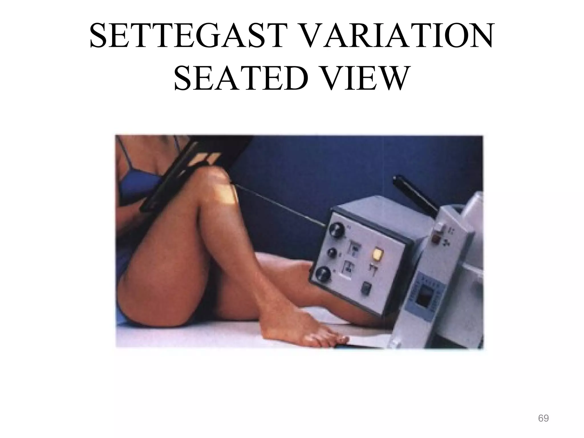 SETTEGAST VARIATION
SEATED VIEW
69
 