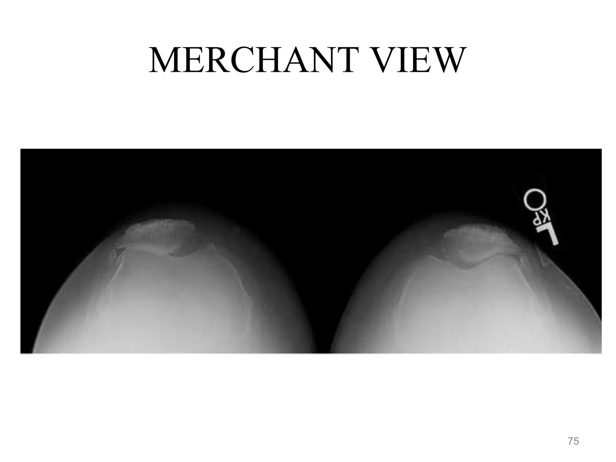 MERCHANT VIEW
75
 