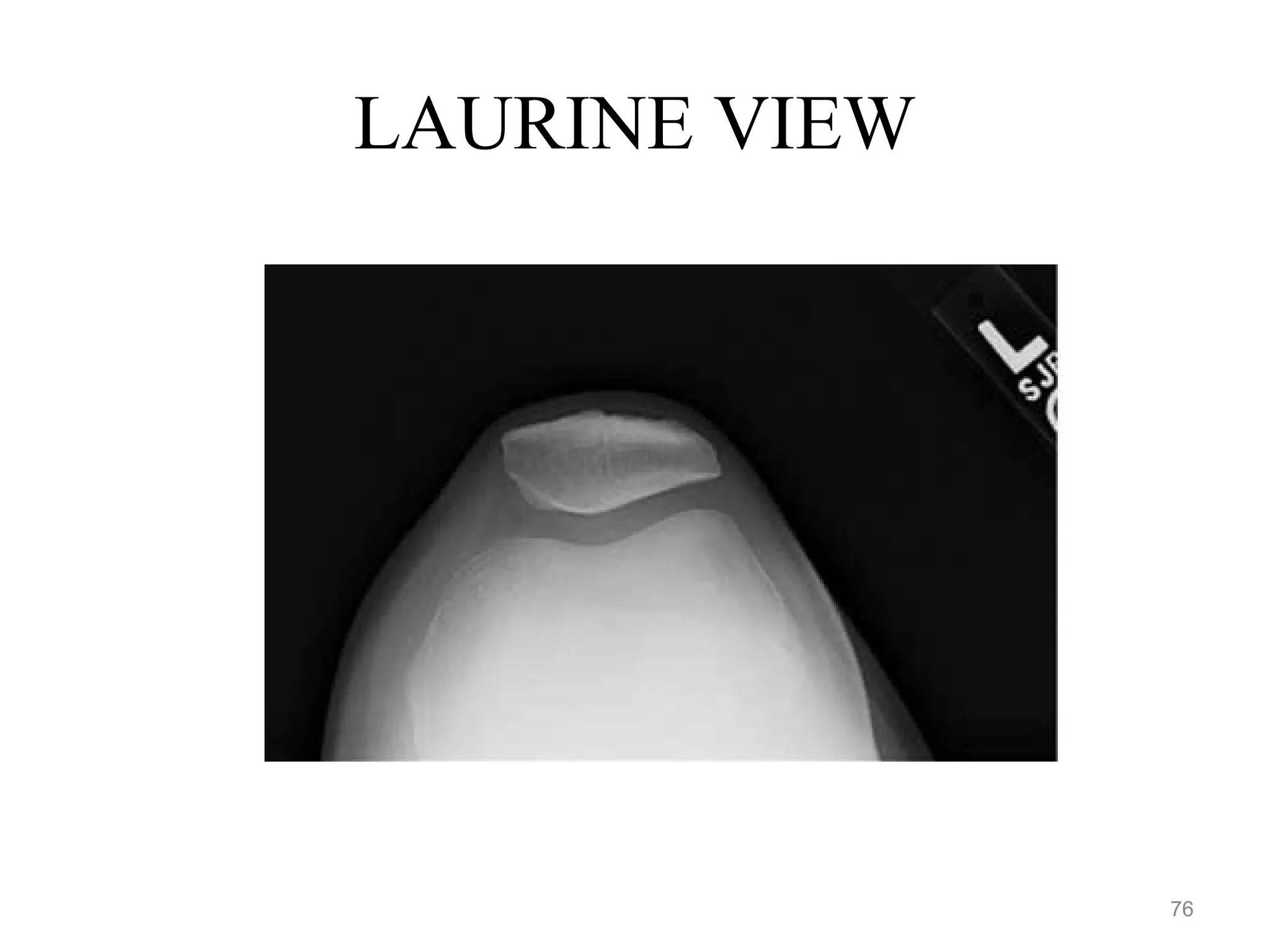 LAURINE VIEW
76
 