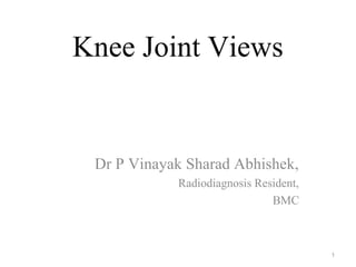 Knee Joint Views
Dr P Vinayak Sharad Abhishek,
Radiodiagnosis Resident,
BMC
1
 