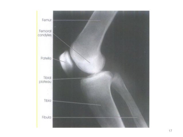 knee xray