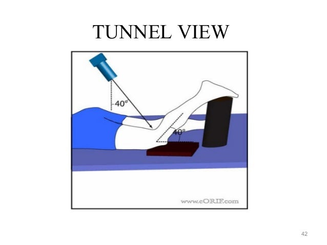 Various X-ray views of Knee Joint