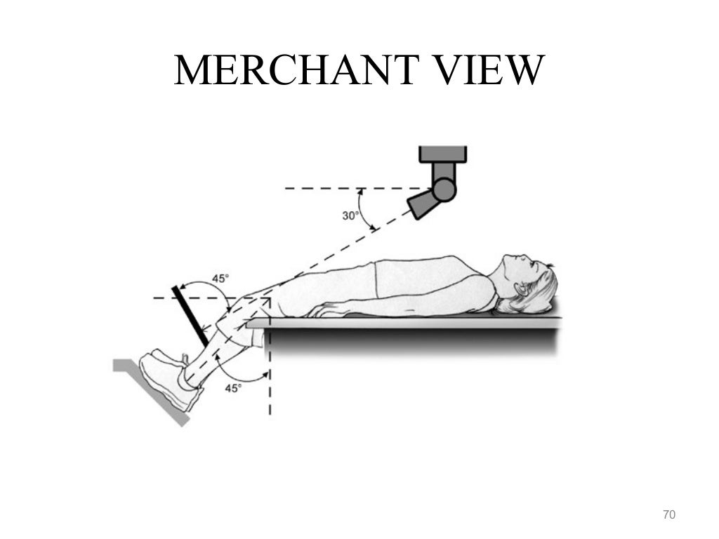 Merchant view patella radiographic positioning