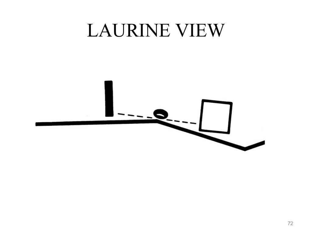 Patella Laurine view