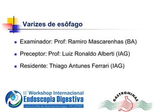 Varizes de esôfago
 Examinador: Prof: Ramiro Mascarenhas (BA)
 Preceptor: Prof: Luiz Ronaldo Alberti (IAG)
 Residente: Thiago Antunes Ferrari (IAG)
 