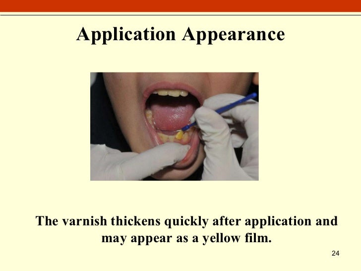 Varnish Application Training