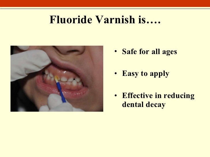 Varnish Application Training