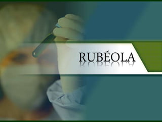 RUBÉOLA
 