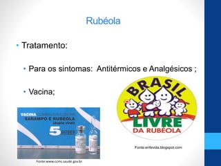 Rubéola
• Tratamento:
• Para os sintomas: Antitérmicos e Analgésicos ;
• Vacina;
Fonte:enfevida.blogspot.com
Fonte:www.ccms.saude.gov.br
 