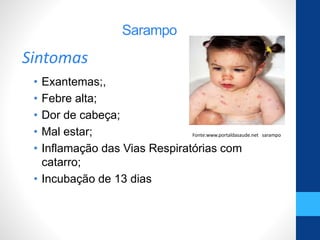 • Exantemas;,
• Febre alta;
• Dor de cabeça;
• Mal estar;
• Inflamação das Vias Respiratórias com
catarro;
• Incubação de 13 dias
Sarampo
Fonte:www.portaldasaude.net sarampo
Sintomas
 