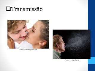 Transmissão
Fonte:pt.wikipedia.org
Fonte:odontomagazine.com
 