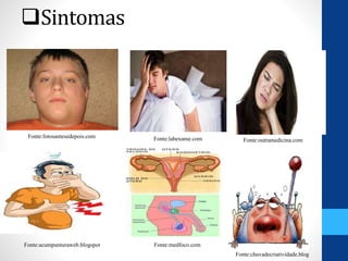Sintomas
Fonte:acumpunturaweb.blogspot
Fonte:chuvadecriatividade.blog
Fonte:fotosantesedepois.com Fonte:labexame.com
Fonte:medfoco.com
Fonte:outramedicina.com
 