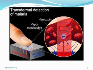 16 September 2014 47 
 