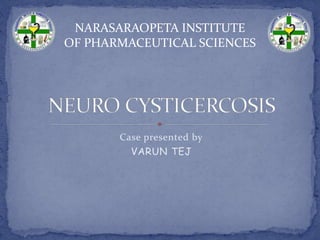 NARASARAOPETA INSTITUTE
OF PHARMACEUTICAL SCIENCES
Case presented by
VARUN TEJ
 