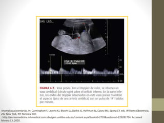 Anomalías placentarias. In: Cunningham F, Leveno KJ, Bloom SL, Dashe JS, Hoffman BL, Casey BM, Spong CY. eds. Williams Obstetricia,
25e New York, NY: McGraw-Hill;
. http://accessmedicina.mhmedical.com.sibulgem.unilibre.edu.co/content.aspx?bookid=2739&sectionid=229281704. Accessed
febrero 13, 2020.
 