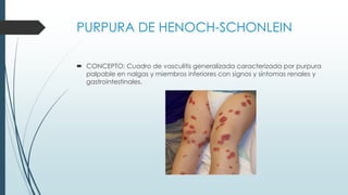 PURPURA DE HENOCH-SCHONLEIN
 CONCEPTO: Cuadro de vasculitis generalizada caracterizada por purpura
palpable en nalgas y miembros inferiores con signos y síntomas renales y
gastrointestinales.
 