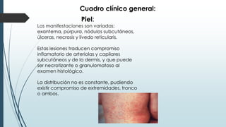 Cuadro clínico general:
Piel:
Las manifestaciones son variadas:
exantema, púrpura, nódulos subcutáneos,
úlceras, necrosis y lívedo reticularis.
Estas lesiones traducen compromiso
inflamatorio de arteriolas y capilares
subcutáneos y de la dermis, y que puede
ser necrotizante o granulomatoso al
examen histológico.
La distribución no es constante, pudiendo
existir compromiso de extremidades, tronco
o ambos.
 