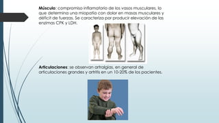 Músculo: compromiso inflamatorio de los vasos musculares, lo
que determina una miopatía con dolor en masas musculares y
déficit de fuerzas. Se caracteriza por producir elevación de las
enzimas CPK y LDH.
Articulaciones: se observan artralgias, en general de
articulaciones grandes y artritis en un 10-20% de los pacientes.
 