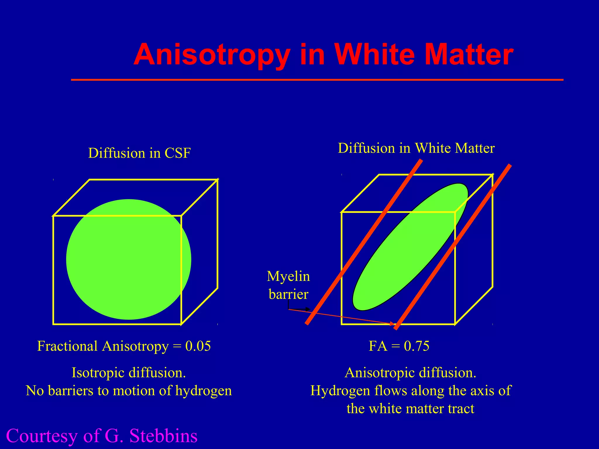 Anisotropy in White Matter
Isotropic diffusion.
No barriers to motion of hydrogen
Diffusion in CSF Diffusion in White Matter
Anisotropic diffusion.
Hydrogen flows along the axis of
the white matter tract
Fractional Anisotropy = 0.05 FA = 0.75
Myelin
barrier
Courtesy of G. Stebbins
 