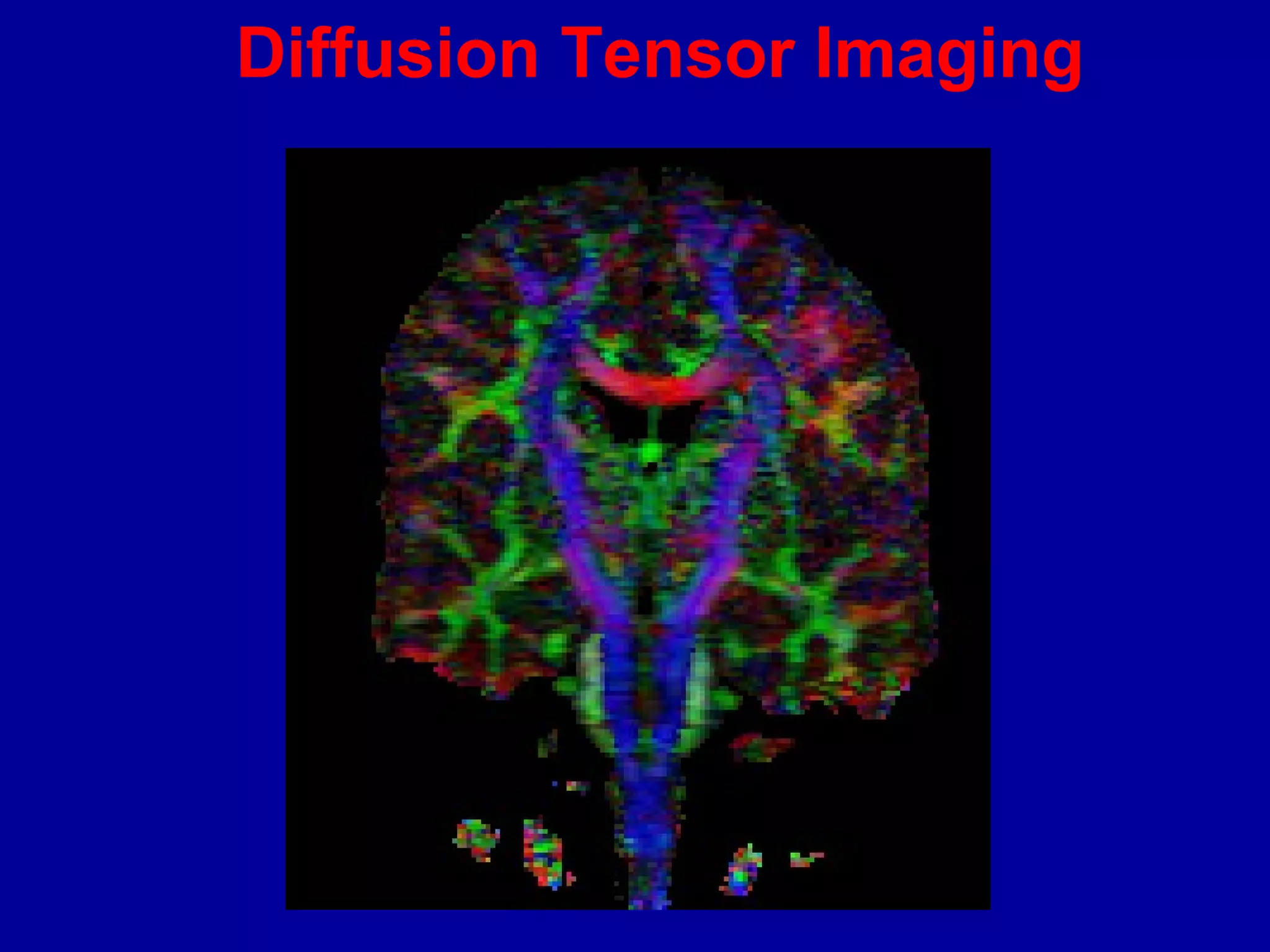 Diffusion Tensor Imaging
 