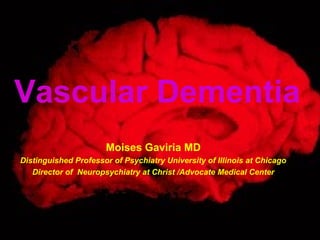 Vascular Dementia
Moises Gaviria MD
Distinguished Professor of Psychiatry University of Illinois at Chicago
Director of Neuropsychiatry at Christ /Advocate Medical Center
 