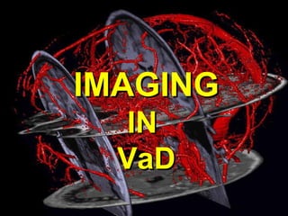 IMAGINGIMAGING
ININ
VaDVaD
 
