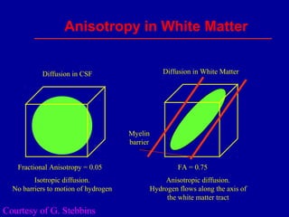 Anisotropy in White Matter
Isotropic diffusion.
No barriers to motion of hydrogen
Diffusion in CSF Diffusion in White Matter
Anisotropic diffusion.
Hydrogen flows along the axis of
the white matter tract
Fractional Anisotropy = 0.05 FA = 0.75
Myelin
barrier
Courtesy of G. Stebbins
 