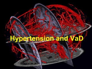 Hypertension and VaD
 