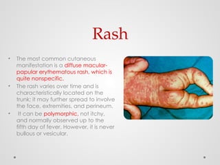 Non Specific Rash VASCUILTIS - common vascular problem in children | PPTX