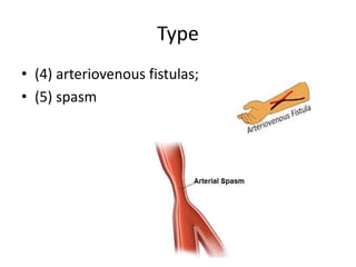 Type
• (4) arteriovenous fistulas;
• (5) spasm

 