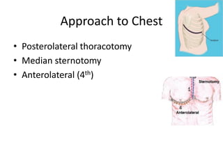 Approach to Chest
• Posterolateral thoracotomy
• Median sternotomy
• Anterolateral (4th)

 