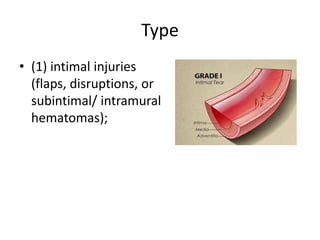 Type
• (1) intimal injuries
(flaps, disruptions, or
subintimal/ intramural
hematomas);

 
