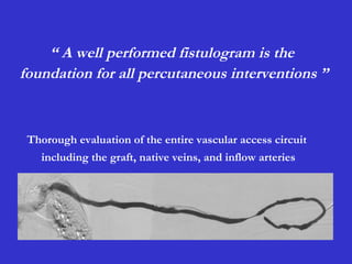 “ A well performed fistulogram is the
foundation for all percutaneous interventions ”
Thorough evaluation of the entire vascular access circuit
including the graft, native veins, and inflow arteries
 