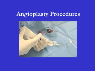 Angioplasty Procedures
 