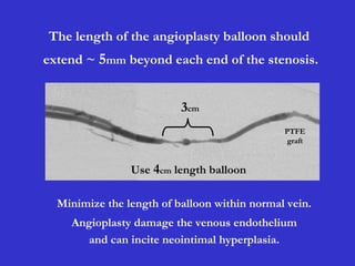 The length of the angioplasty balloon should
extend ~ 5mm beyond each end of the stenosis.
PTFE
graft
3cm
Use 4cm length balloon
Minimize the length of balloon within normal vein.
Angioplasty damage the venous endothelium
and can incite neointimal hyperplasia.
 