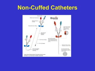 Non-Cuffed Catheters
 